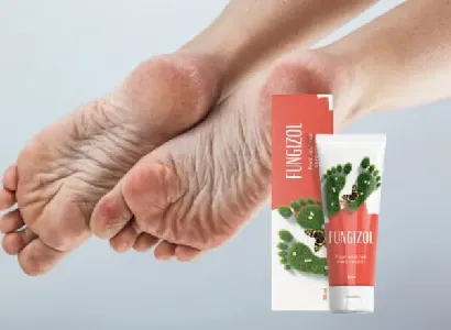 Fungizol Cream #5