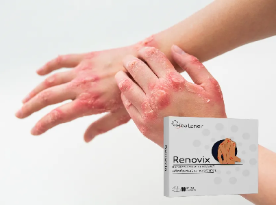 Renovix #1